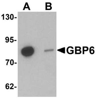 GBP6 Antibody