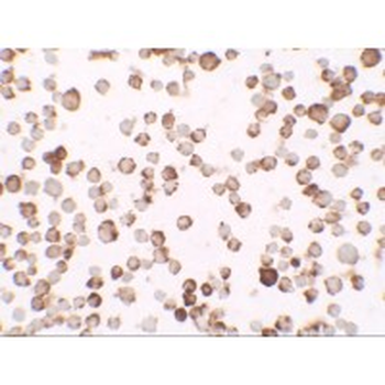 RNASET2 Antibody