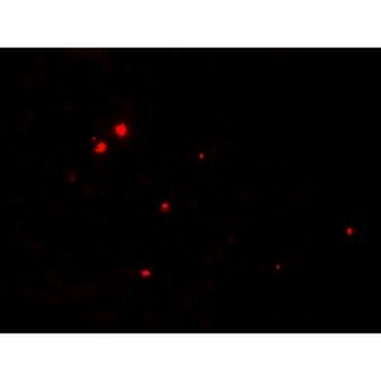 RNASET2 Antibody