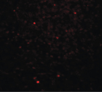 CLEC7A/Dectin 1 Antibody