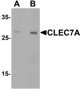 CLEC7A/Dectin 1 Antibody