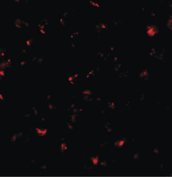 CBT1/SDHD Antibody