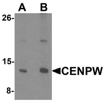 CENPW/C6orf173 Antibody