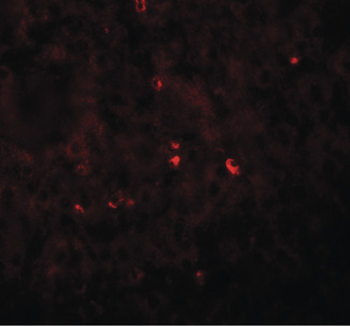 Angiogenin/ANG Antibody