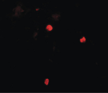 KEAP1 Antibody
