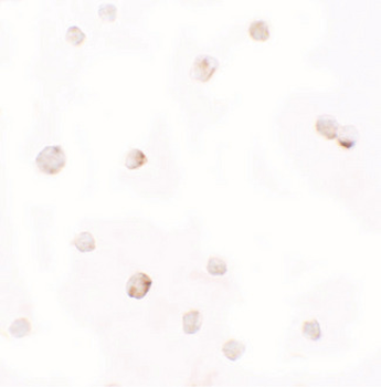 PELI1/Pellino 1 Antibody