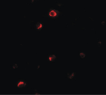 PELI1/Pellino 1 Antibody