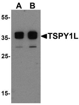 TSPY1/TSPY Antibody