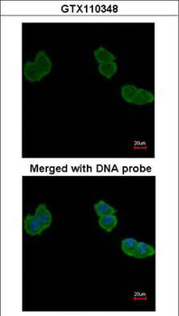 ACY1/Aminoacylase 1 Antibody