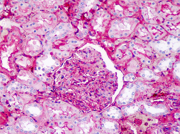 APOA1/Apolipoprotein A 1 Antibody