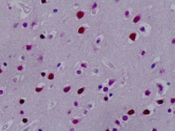 SYNCRIP/HnRNP Q Antibody