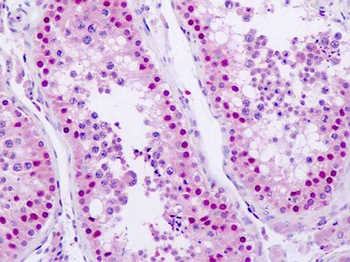 ANKRD30A/NY-BR-1 Antibody