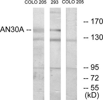 ANKRD30A/NY-BR-1 Antibody