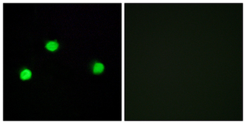 IP6K2 Antibody