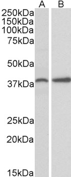 PRKCDBP/CAVIN3 Antibody