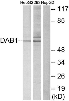 DAB1 Antibody