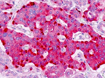 PTPRN2/Phogrin Antibody