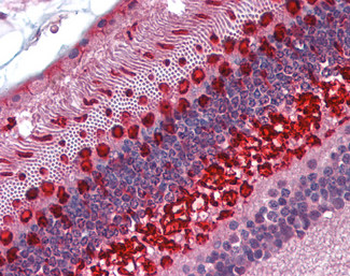 ARR3/Cone Arrestin Antibody
