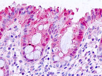 LGALS3/Galectin 3 Antibody