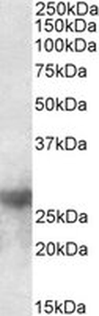LGALS3/Galectin 3 Antibody
