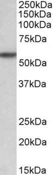 TGFBR1/ALK5 Antibody