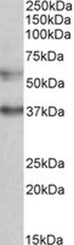 MICU1/CBARA1 Antibody