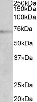 DBH/Dopamine Beta Hydroxylase Antibody