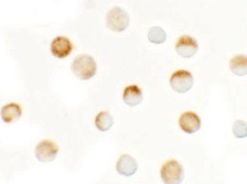 SLC35D3/FRCL1 Antibody