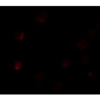 SLC35D3/FRCL1 Antibody