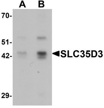 SLC35D3/FRCL1 Antibody
