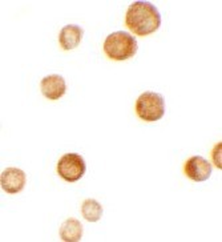 CASKIN2 Antibody