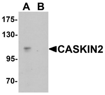 CASKIN2 Antibody