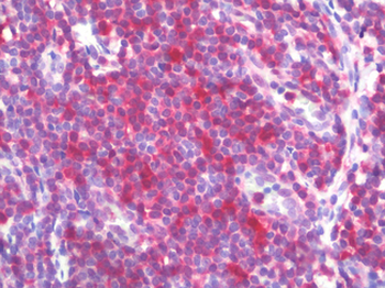 STAT1 Antibody