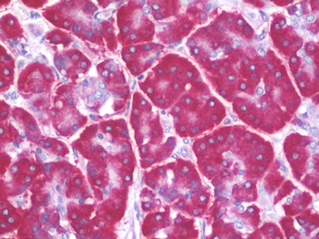 RPS4X + RPS4Y1 + RPS Antibody