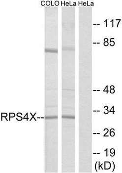 RPS4X + RPS4Y1 + RPS Antibody