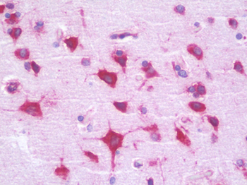 RPL35/Ribosomal Protein L35 Antibody