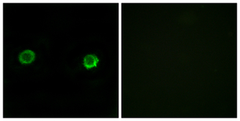 ABHD2 Antibody