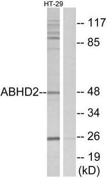 ABHD2 Antibody