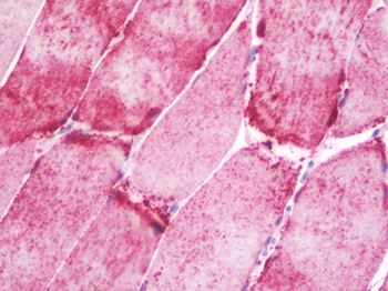 NT5C1A/CN1A Antibody