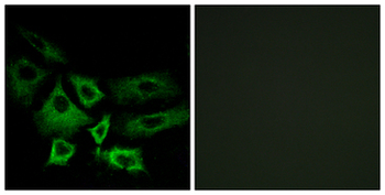 NT5C1A/CN1A Antibody