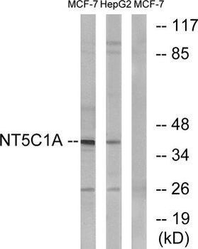NT5C1A/CN1A Antibody