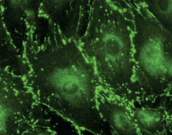 GJA1/CX43/Connexin 43 Antibody