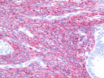 GJA1/CX43/Connexin 43 Antibody