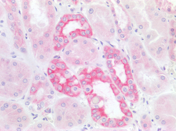 TJP1/ZO-1 Antibody