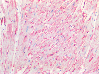 CAV1/Caveolin 1 Antibody