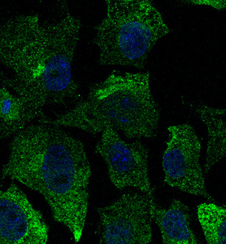 CAV1/Caveolin 1 Antibody