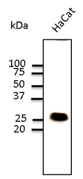 CAV1/Caveolin 1 Antibody