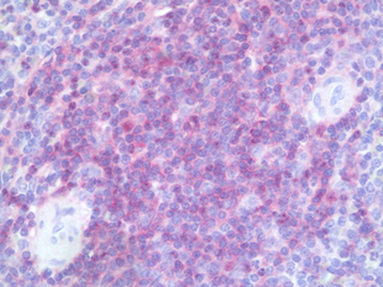 CD4 Antibody