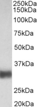 SFTPA1 + SFTPA2 Antibody