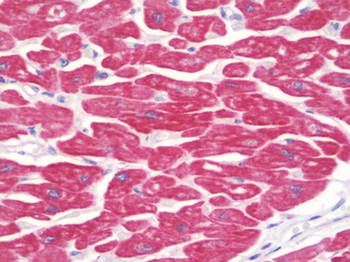 MYOM2/Myomesin 2 Antibody